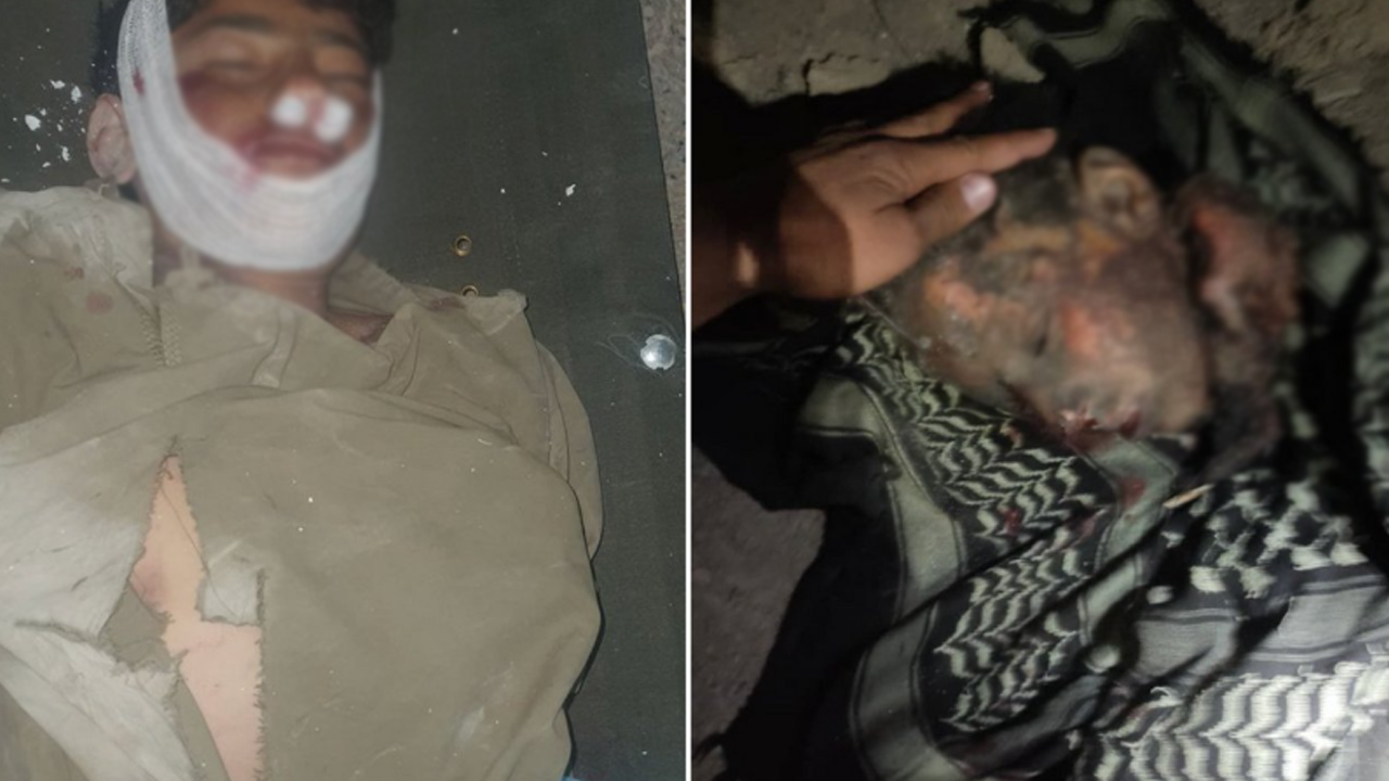 Pakistan ateşkesi ihlal edip Afganistan'da sivilleri katletti!