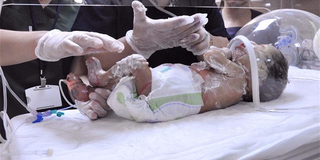 'Palyaço bebek' yaşam savaşı veriyor