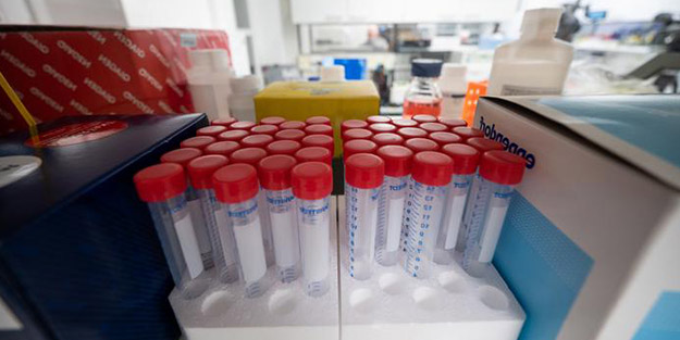 Paran yoksa test de yok! Batı illüzyonu virüsle çöktü