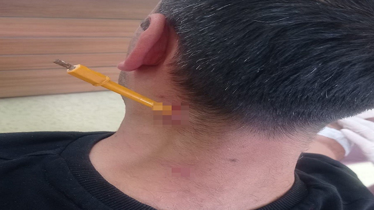 Park yeri tartışmasında dehşet: Boynuna tornavida sapladı