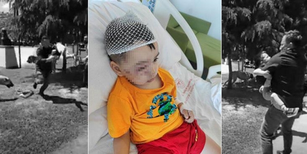 Parkta düzenlenen Patili Dostlar Güzellik Yarışması'nda dehşet! Başıboş bırakılan köpek 3,5 yaşındaki bebeği gözünden ısırdı