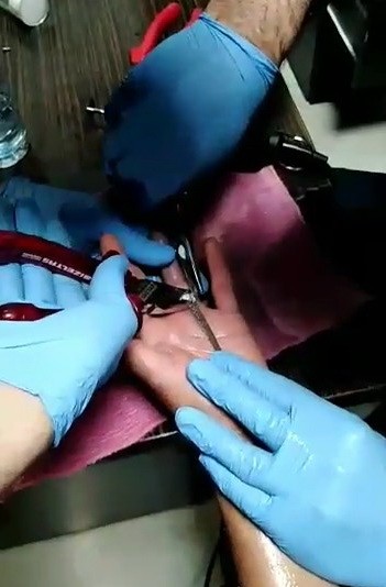 Parmağa sıkışan yüzüğü itfaiye çıkarttı 