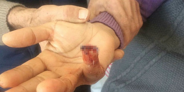 Parmağı kayıp! Komşusu mu yuttu?