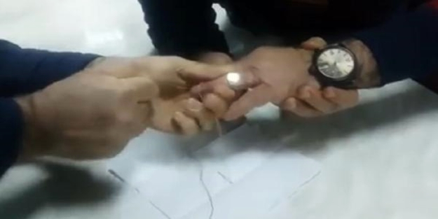 Parmağına sıkışan yüzüğü bakın kim çıkardı