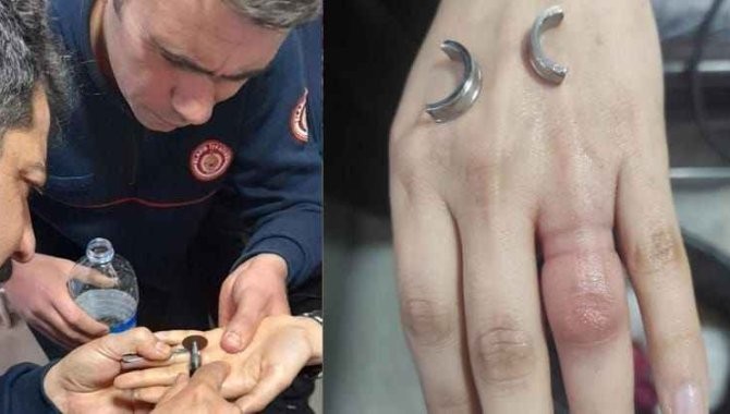 Parmağına yüzük sıkışan kadın, İtfaiye ekiplerini seferber etti!