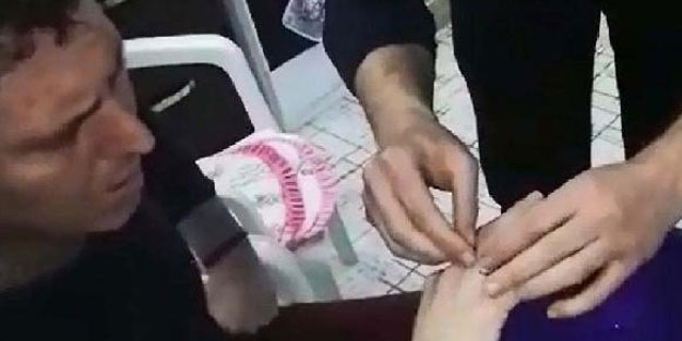 Parmağında sıkışan yüzük kesilerek çıkarıldı