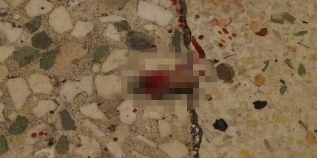 Parmağını bırakıp kaçtı!