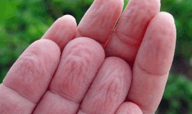 Parmaklar suda neden buruşur?