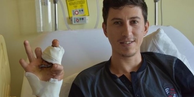 Parmaklarını kaybedince bakın ne yaptılar!