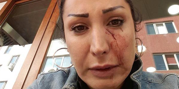 Patatesi değiştirmesini istediği garson öyle bir şey yaptı ki!