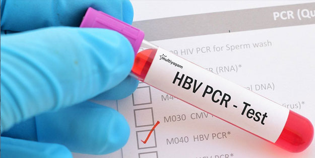 PCR testi ücreti belli oldu! PCR test ücreti ne kadar?