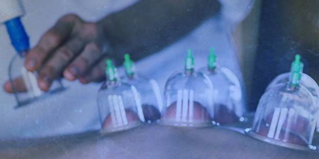 Peygamberimizin tavsiyesine Batılılar da ilgi gösteriyor! Hacamatın saymakla bitmeyen faydalarını duyunca şoke olacaksınız!