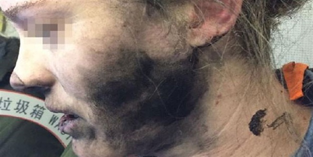 Pilli kulaklık bu hâle getirdi!