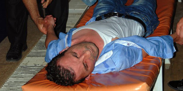 İşte sara nöbetlerini azaltan tedavi