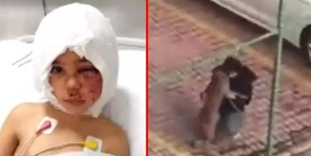 Pitbull saldırısında ağır yaralanan Asiye'den kötü haber!