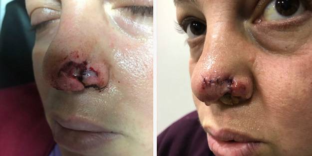 Pitbull vahşeti daha çok can yakacak: Etlerimin sallandığını hissettim!