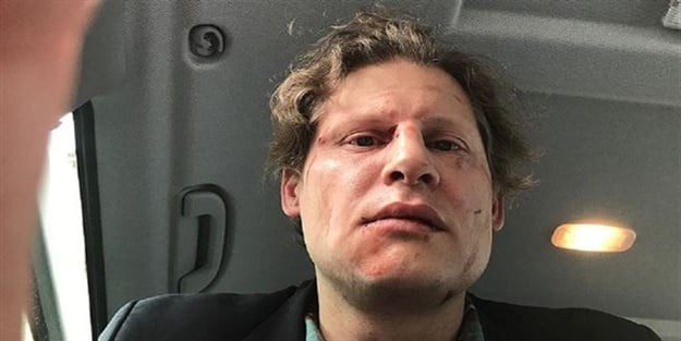 PKK yandaşları Alman gazeteciyi darbetti