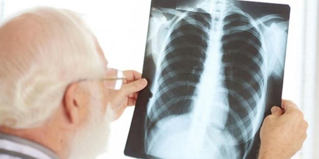 Pnömonili hasta nedir?