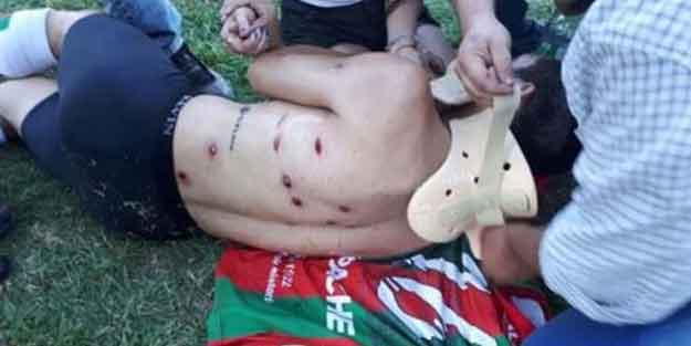 Polis futbolculara plastik mermi sıktı