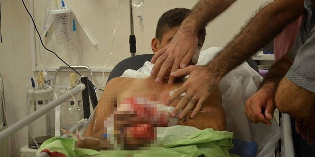 Polise atacaktı, elinde patladı!