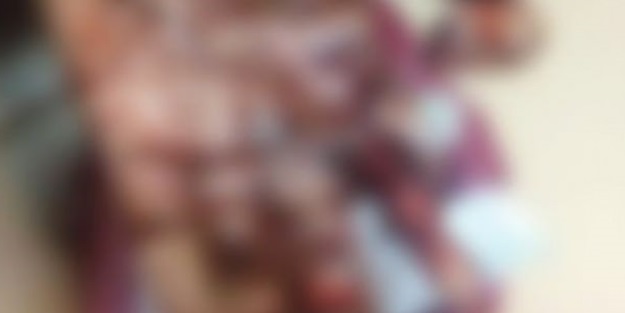 Polise atmak istediği bomba elinde patladı