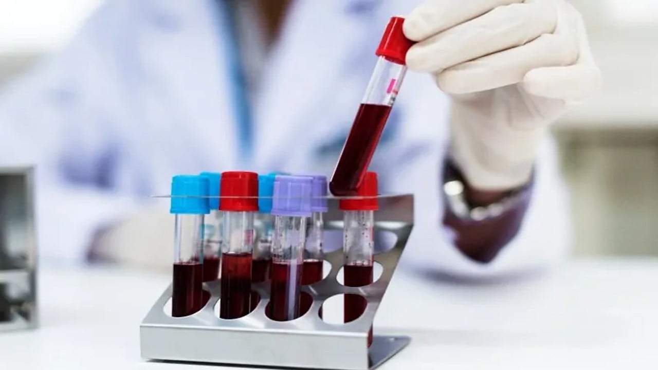 Pozitif çıkan uyuşturucu test sonuçlarını para karşılığı negatif olarak değiştiriyorlardı