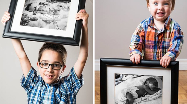 Prematüre bebeklerin inanılmaz değişimi - FOTO