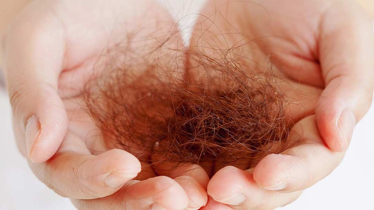 Prof. Dr. Canan Karatay önerdi: Kellik sona eriyor! Avuç avuç dökülen saçları yeniden çıkarıyor!