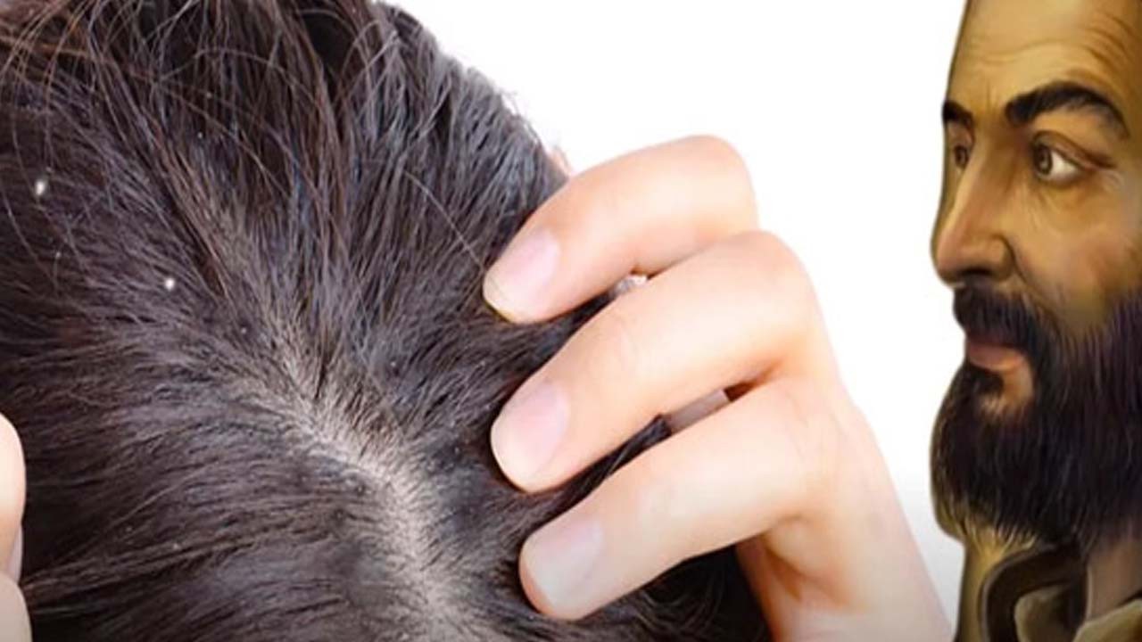 Rahatsız edici beyaz saçlar tarihe karışacak! İbn-i Sina'nın formülü: bilinmeyen ortaya çıktı