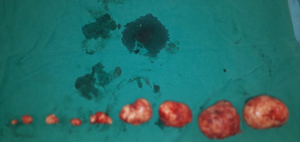 Rahminden 1 kiloluk ur çıktı 