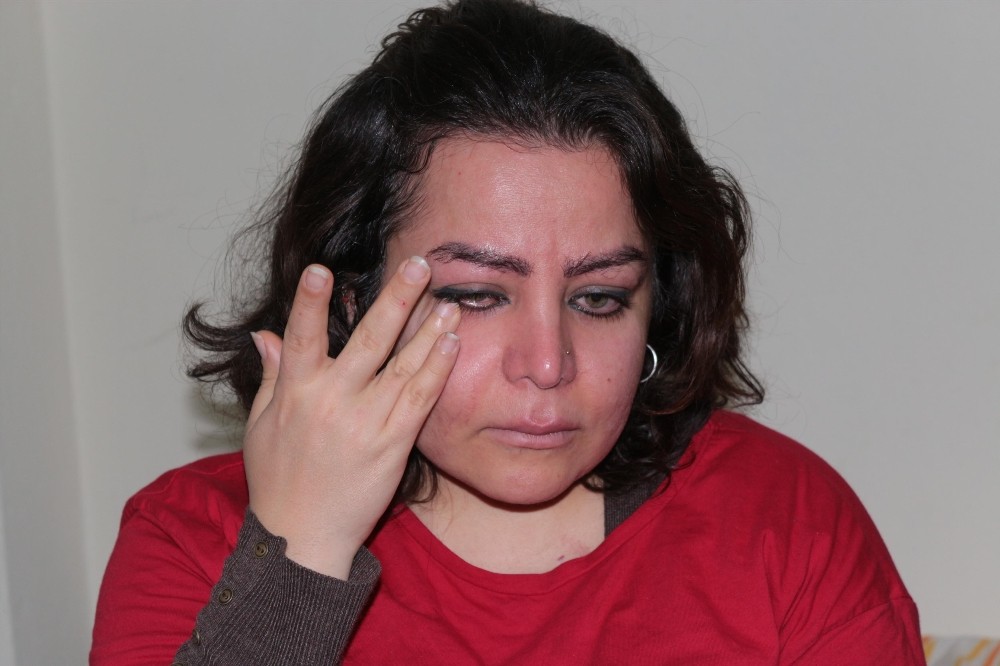Raşitizm hastası İranlı Bavadi hem iş, hem de tedavi olmak istiyor 