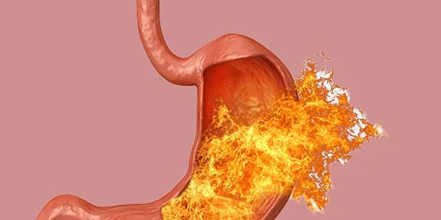 Reflü için doğal çözümler sunuyoruz: Tam bir doğal ilaç! Bu formül ezberleri bozdu