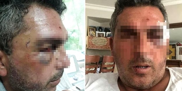 Resmen insanlıktan çıkmışlar! Döverek bayılttıktan sonra...
