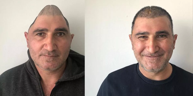 Eski görüntüsüne böyle kavuştu