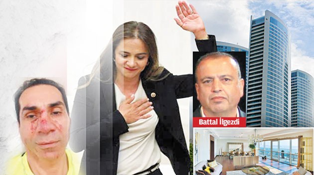 Rezidansa kan sıçradı