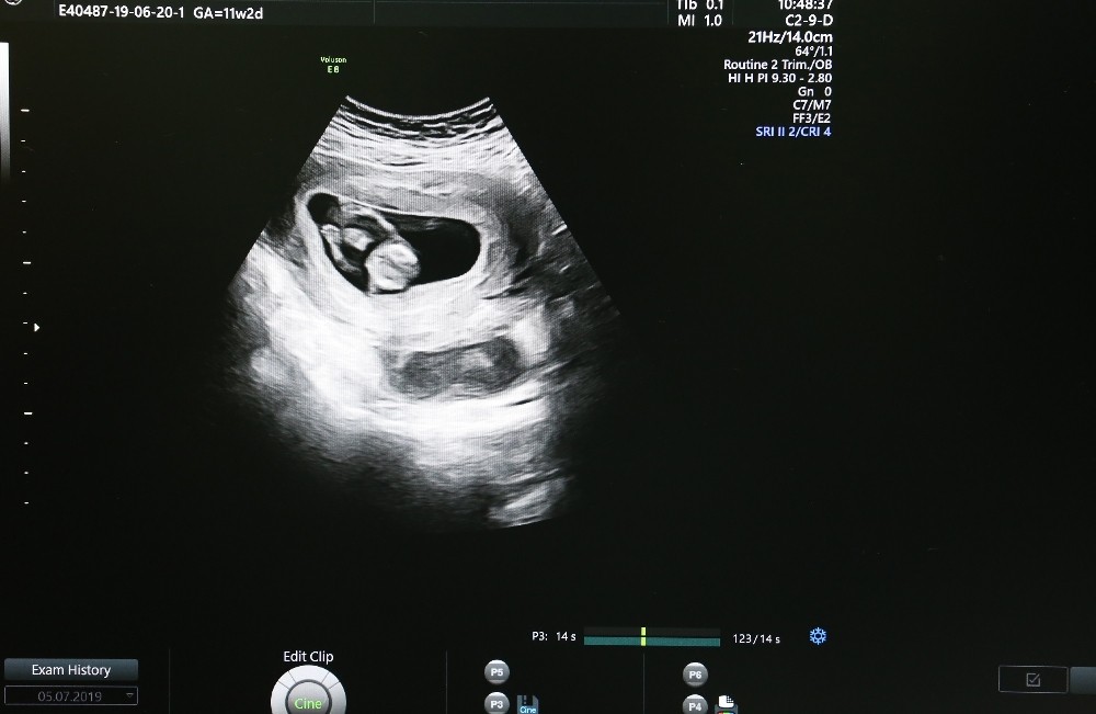 Riskli gebeliklerin takibi kolaylıkla yapılabilecek 