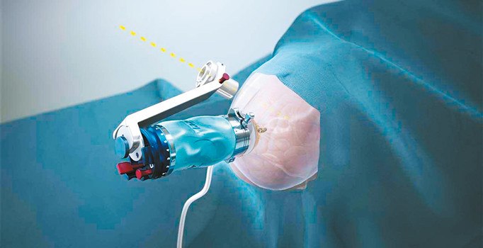 Robot cerrah masada bırakmayacak