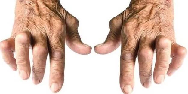 Romatizma için doğru bilenen yanlış