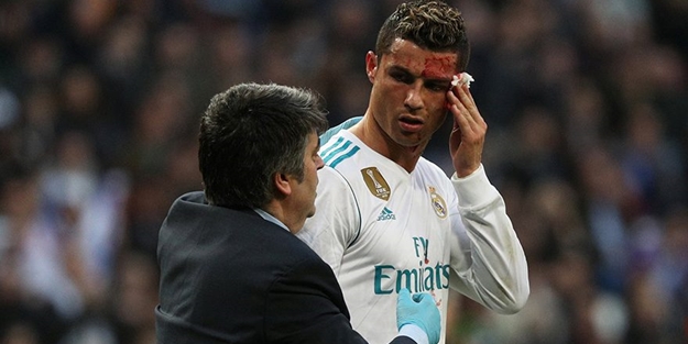 Ronaldo kanlar içerisinde kaldı