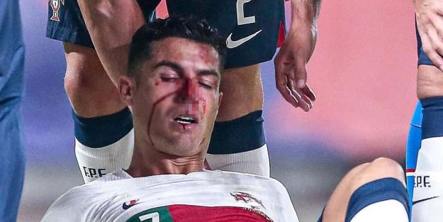 Ronaldo kanlar içinde kaldı