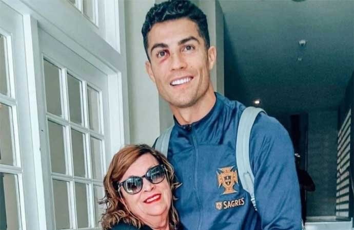 Ronaldo’nun yüzündeki morlukların sebebi...