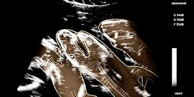 Röntgen sonrası çıkanlar doktorları bile şok etti! İşte açıklanamayan o görüntüler