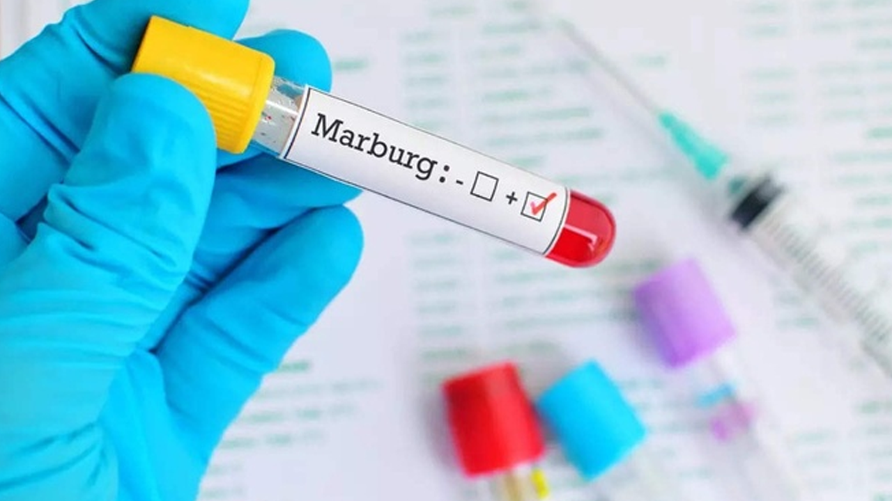 Ruanda'da ölümcül Marburg virüsü salgını