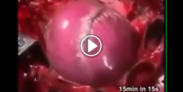 Ruh bedenden çıkarken insanın kalbini böyle duruyor!