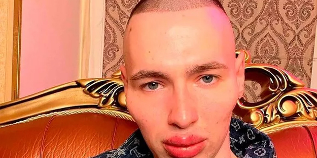 Rus askeri: Uzaylıya benzemek için defalarca bıçak altına yattı