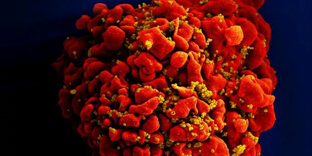 Rus doktor hatırlattı: Yılda 1 milyon kişiyi öldüren virüsün aşısı hala bulunamadı