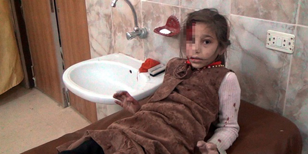 Ruslar çocukları vuruyor!