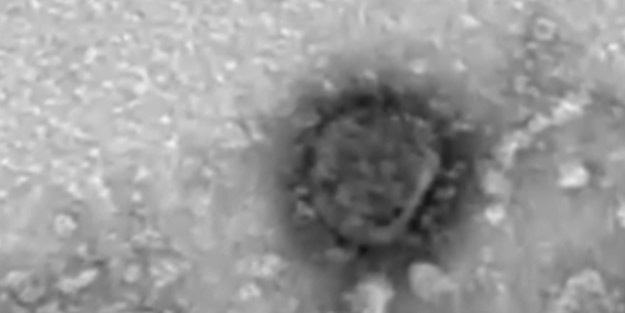 Ruslar servis etti! Dünyayı etkisi altına alan koronavirüsün mikroskop görüntüleri ortaya çıktı