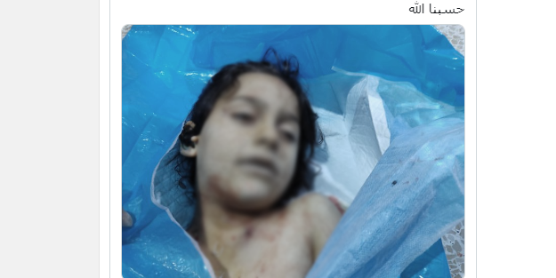 Rusya destekli Esed rejimi 3 çocuğu katletti