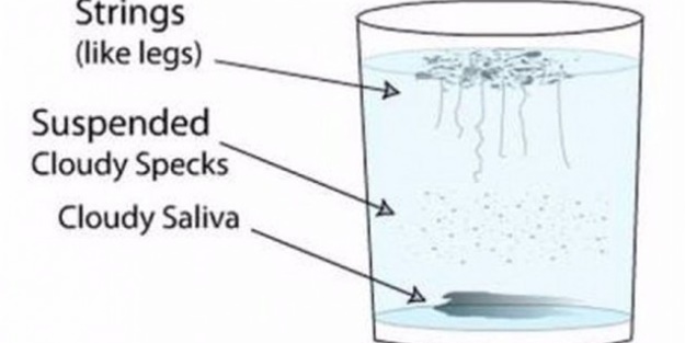 Sabah bir bardak suya tükürün...